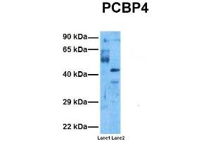 Host:  Rabbit  Target Name:  PCBP4  Sample Tissue:  Human Ovary Tumor, Human 293T  Antibody Dilution:  1. (PCBP4 anticorps  (C-Term))