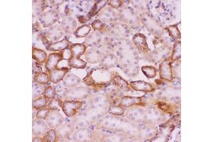 Anti-SLC9A1 Picoband antibody,  IHC(P): Rat Kidney Tissue