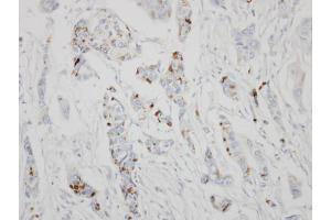 IHC-P Image Immunohistochemical analysis of paraffin-embedded HBL435 xenograft, using GALNT6, antibody at 1:500 dilution.