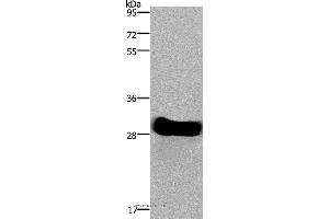 Western blot analysis of Mouse heart tissue, using FHL2 Polyclonal Antibody at dilution of 1:1900 (FHL2 anticorps)