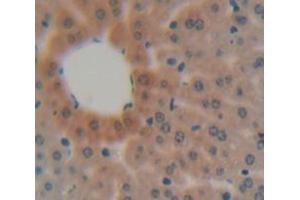 IHC-P analysis of liver tissue, with DAB staining. (MBL2 anticorps  (AA 19-244))
