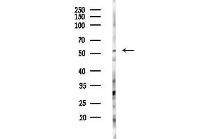 Western blot analysis of lysates from PC12 cells(LPS 4h treatment), using Phospho-Chk1 (Ser286) Antibody at 1/1000 dilution.