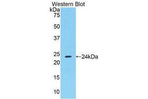 Western Blotting (WB) image for anti-Fibrinogen alpha Chain (FGA) (AA 357-556) antibody (ABIN1174272) (FGA anticorps  (AA 357-556))