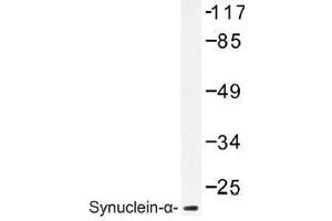 Image no. 1 for anti-Synuclein, alpha (SNCA) antibody (ABIN317944) (SNCA anticorps)