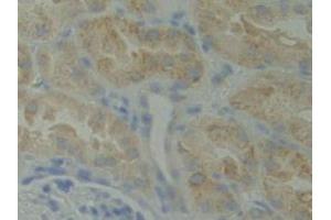 Detection of BMX in Human Kidney Tissue using Polyclonal Antibody to BMX Non Receptor Tyrosine Kinase (BMX) (BMX anticorps  (AA 287-523))