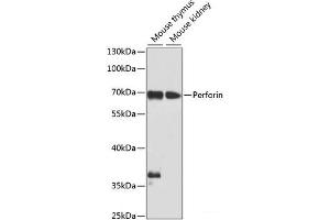 Western blot analysis of extracts of various cell lines using Perforin Polyclonal Antibody at dilution of 1:1000. (Perforin 1 anticorps)