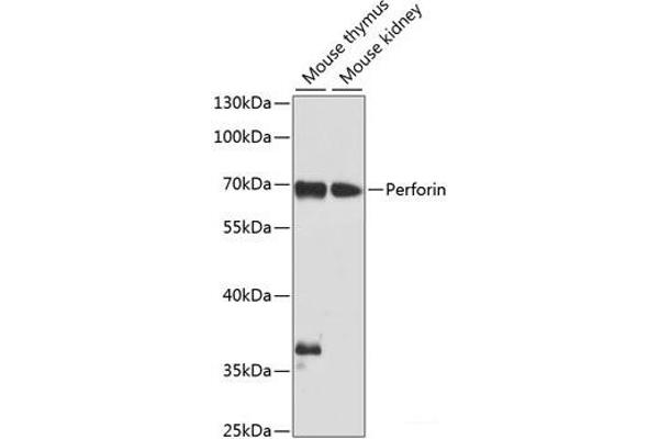 Perforin 1 anticorps