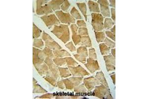 ARHGAP10 antibody (Center) immunohistochemistry analysis in formalin fixed and paraffin embedded human skeletal muscle followed by peroxidase conjugation of the secondary antibody and DAB staining. (ARHGAP10 anticorps  (Middle Region))