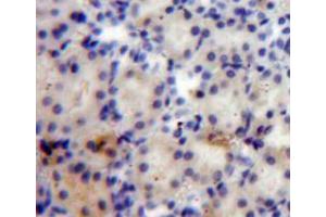 IHC-P analysis of kidney tissue, with DAB staining. (ANGPTL4 anticorps  (AA 182-394))