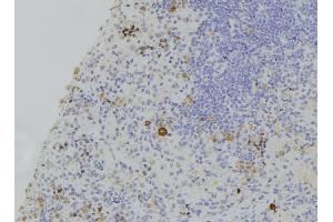 ABIN6273119 at 1/100 staining Human lymph node tissue by IHC-P. (GSDMD anticorps)
