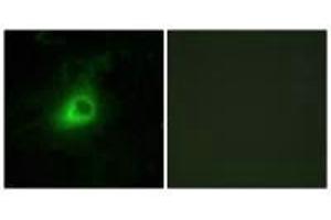 Immunofluorescence analysis of HeLa cells, using GRK6 antibody.