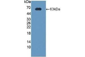 Detection of Recombinant CRHBP, Rat using Polyclonal Antibody to Corticotropin Releasing Hormone Binding Protein (CRHBP)