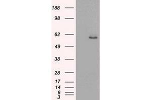 HEK293T cells were transfected with the pCMV6-ENTRY control (Left lane) or pCMV6-ENTRY KRT8 (Right lane) cDNA for 48 hrs and lysed. (KRT8 anticorps  (AA 91-381))