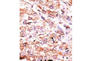 anti-Guanylyl Cyclase alpha 2 (AA 105-136), (N-Term) antibody