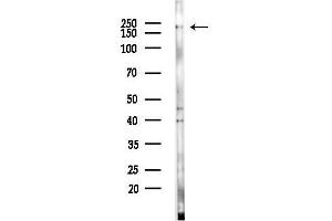 anti-Collagen, Type II (COL2) (N-Term) antibody