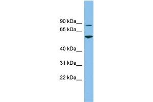 WB Suggested Anti-VPS52 Antibody Titration: 0. (VPS52 anticorps  (Middle Region))