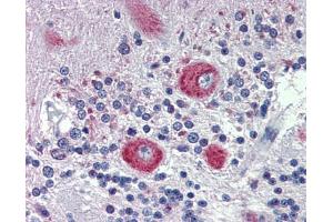 Rabbit Anti-GRHL2 Antibody    Paraffin Embedded Tissue: Human Brain  Antibody Concentration: 5 ug/ml