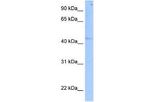 SETD7 antibody used at 5 ug/ml to detect target protein.