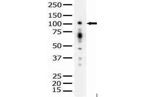 Image no. 1 for anti-Protein Kinase D1 (PRKD1) antibody (ABIN272066) (PKC mu anticorps)