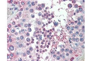 MED4 antibody was used for immunohistochemistry at a concentration of 4-8 ug/ml.
