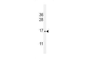 Western blot analysis in HepG2 cell line lysates (35ug/lane). (CST9 anticorps  (C-Term))