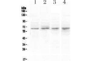 Western blot analysis of CCKBR using anti-CCKBR antibody .