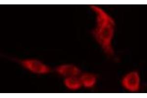 ABIN6274154 staining 293 cells by IF/ICC. (HNRNPC anticorps  (C-Term))