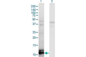 Western Blot analysis of TIAF1 expression in transfected 293T cell line by TIAF1 monoclonal antibody (M04), clone 3B9. (TIAF1 anticorps  (AA 1-115))