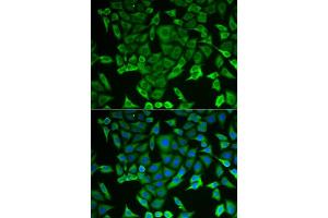 Immunofluorescence analysis of MCF-7 cells using RARS antibody (ABIN5973728). (RARS anticorps)