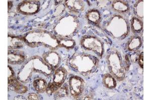 Image no. 13 for anti-Galactosidase, beta 1 (GLB1) antibody (ABIN1498467)