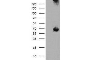 Image no. 4 for anti-Mitogen-Activated Protein Kinase Kinase 3 (MAP2K3) antibody (ABIN1499398)