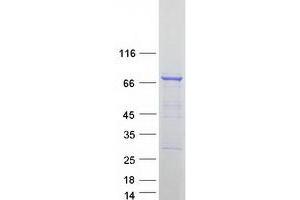 Validation with Western Blot