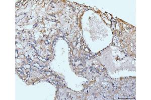 IHC analysis of COL6A1 using anti-COL6A1 antibody (ABIN7600515).