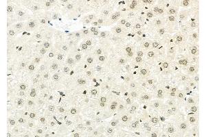 ABIN6264970 and ABIN6273316 at 1/100 staining Mouse liver tissue by IHC-P.