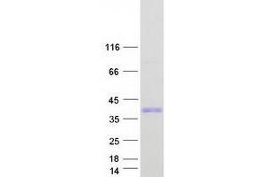 Spindle and Kinetochore Associated Complex Subunit 1 (SKA1) (Transcript Variant 1) protein (Myc-DYKDDDDK Tag)