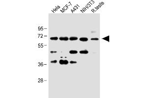 All lanes : Anti-CDC25A at 1:1000 dilution Lane 1: Hela whole cell lysate Lane 2: MCF-7 whole cell lysate Lane 3: A431 whole cell lysate Lane 4: NIH/3T3 whole cell lysate Lane 5: Rat testis lysate Lysates/proteins at 20 μg per lane.