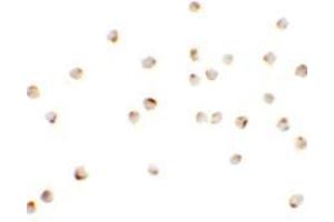 Immunocytochemistry of TSHZ1 in A20 cells with TSHZ1 antibody at 2.