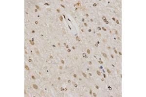 Immunohistochemistry of paraffin-embedded rat brain using TriMethyl-Histone H3-K79 antibody. (Histone 3 anticorps  (H3K79me3))