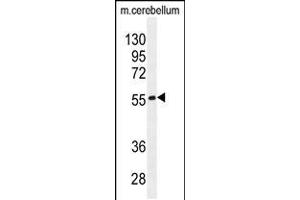 Western blot analysis in mouse cerebellum tissue lysates (35ug/lane). (FAM69B anticorps  (N-Term))