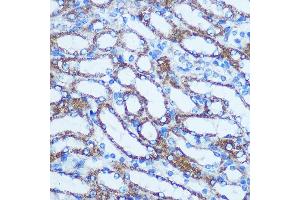 Immunohistochemistry of paraffin-embedded Mouse kidney using GSTT1 Rabbit pAb (ABIN3021870, ABIN3021871, ABIN3021872, ABIN1512971 and ABIN6216656) at dilution of 1:100 (40x lens).
