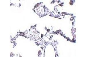 Immunohistochemistry of CD81 in human lung tissue with CD81 antibody at 5 μg/ml. (CD81 anticorps  (N-Term))