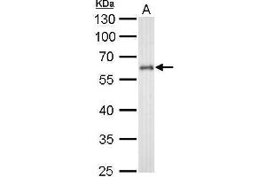 WB Image CYP1B1 antibody detects CYP1B1 protein by Western blot analysis.