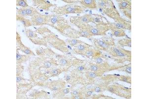 Immunohistochemistry of paraffin-embedded Human liver using NUDT15 Polyclonal Antibody at dilution of 1:100 (40x lens). (NUDT15 anticorps)