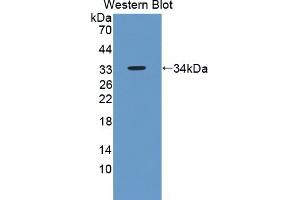Detection of Recombinant ENDOG, Human using Polyclonal Antibody to Endonuclease G, Mitochondrial (ENDOG) (Endonuclease G anticorps  (AA 16-290))