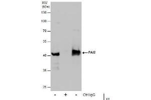 IP Image Immunoprecipitation of PAI2 protein from U87-MG whole cell extracts using 5 μg of PAI2 antibody, Western blot analysis was performed using PAI2 antibody, EasyBlot anti-Rabbit IgG  was used as a secondary reagent.