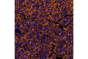 Immunofluorescence (IF) image for anti-Poliovirus Receptor (PVR) (AA 28-329) antibody (ABIN7449549) (Recombinant Poliovirus Receptor anticorps  (AA 28-329))