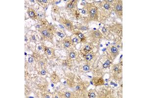 Immunohistochemistry of paraffin-embedded human liver injury using AMY2A antibody (ABIN5975245) at dilution of 1/100 (40x lens). (AMY2A anticorps)
