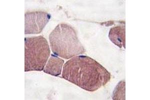 IHC analysis of FFPE human skeletal muscle tissue stained with UCHL3 antibody (UCHL3 anticorps  (AA 195-225))