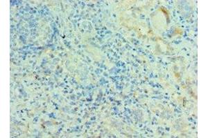 Immunohistochemistry of paraffin-embedded human kidney tissue using ABIN7142389 at dilution of 1:100