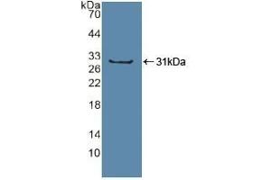Detection of Recombinant Sp100, Human using Polyclonal Antibody to Sp100 Nuclear Antigen (Sp100) (SP100 anticorps  (AA 610-802))